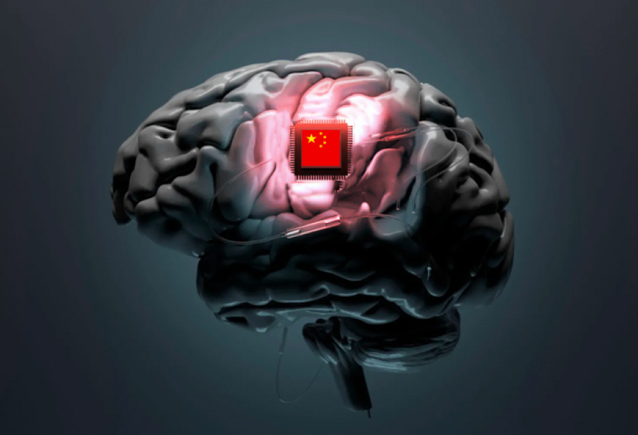 China's homegrown brain-machine interface system unveiled at Zhongguancun Forum